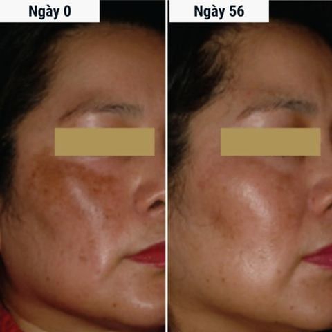 Kem Chống Nắng 4 Trong 1 DermEden Day Cream Global Action Combination Skin SPF 50 PA+++