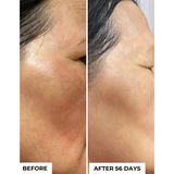 Tinh Chất Giảm Nám, Mờ Tàn Nhang TXA 3% DermEden Anti-Taches 30ml